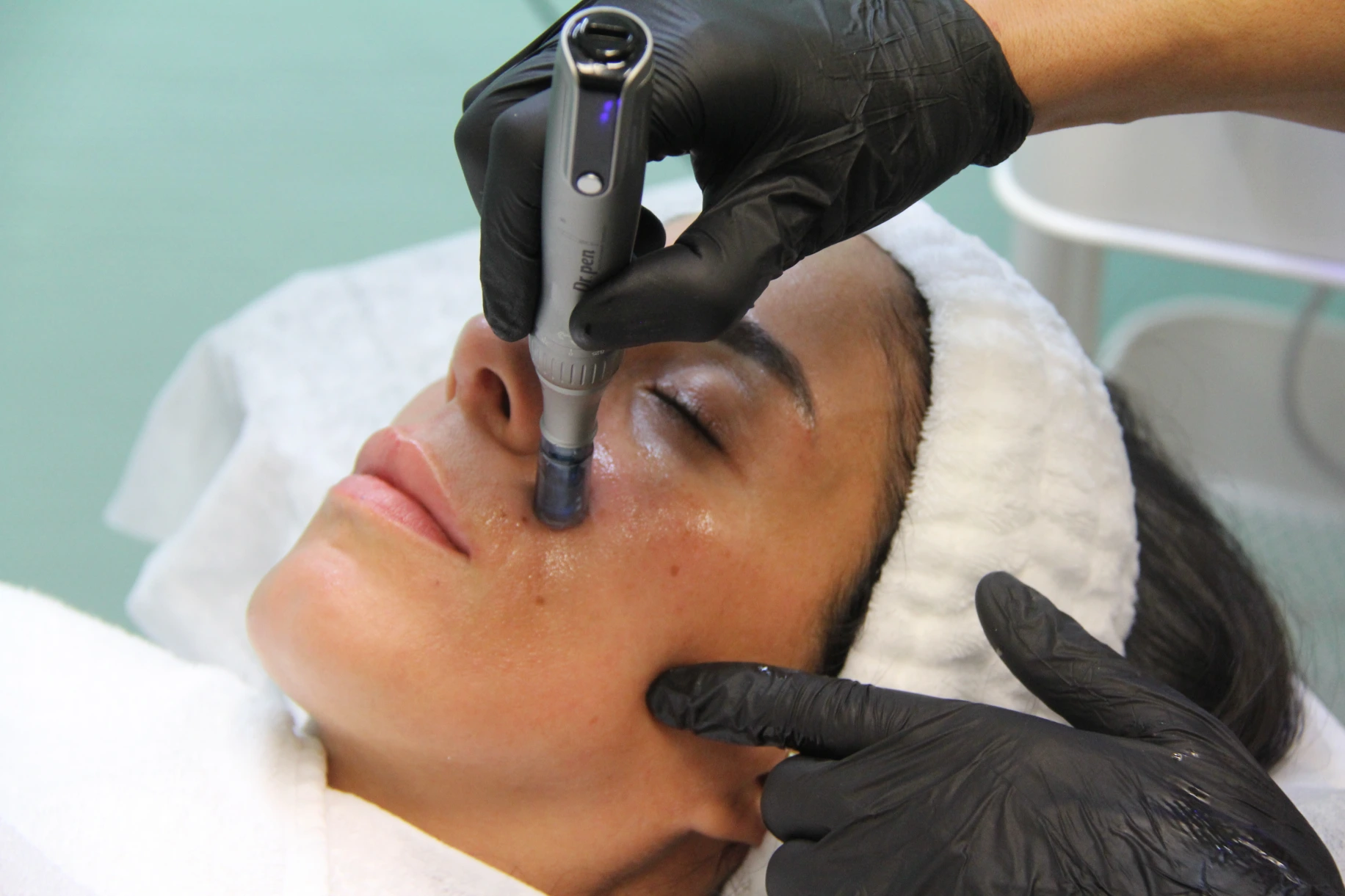 Microneedling im Studio Ginié Heidelberg für Hautstruktur und Glow